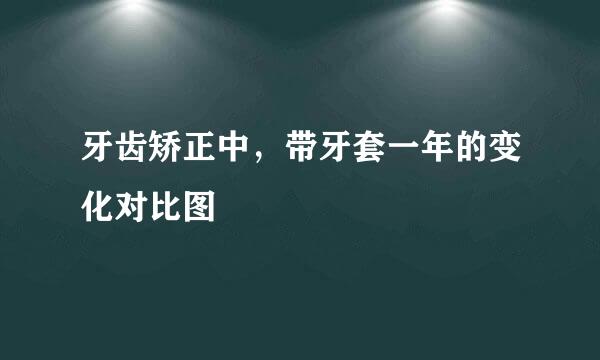 牙齿矫正中，带牙套一年的变化对比图