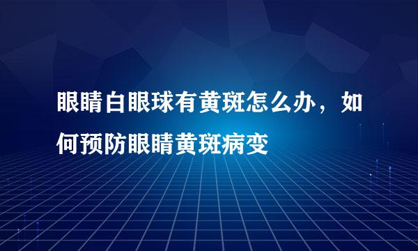 眼睛白眼球有黄斑怎么办，如何预防眼睛黄斑病变