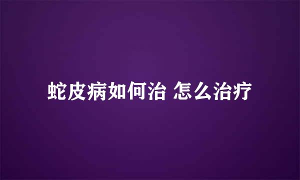 蛇皮病如何治 怎么治疗