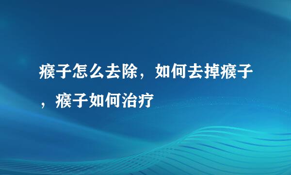 瘊子怎么去除，如何去掉瘊子，瘊子如何治疗