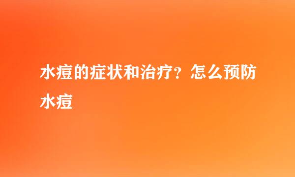 水痘的症状和治疗？怎么预防水痘