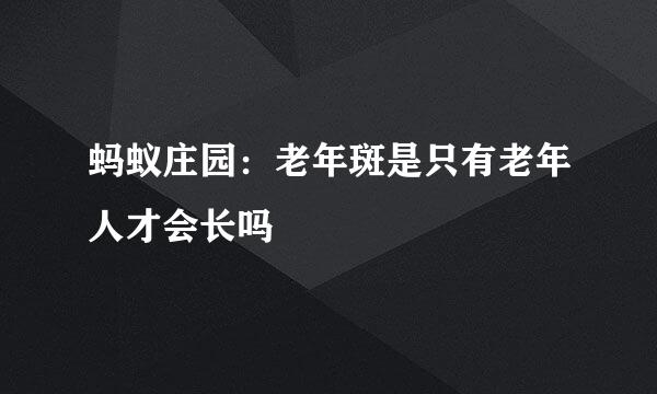 蚂蚁庄园：老年斑是只有老年人才会长吗