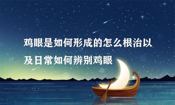 鸡眼是如何形成的怎么根治以及日常如何辨别鸡眼