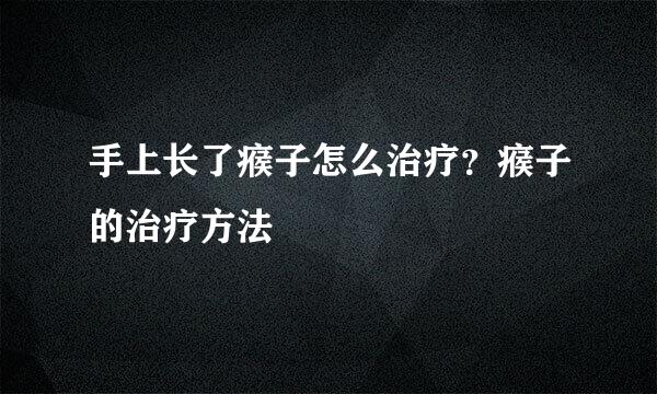 手上长了瘊子怎么治疗？瘊子的治疗方法