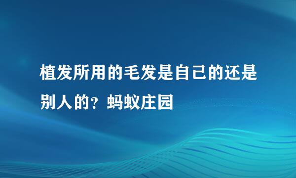 植发所用的毛发是自己的还是别人的？蚂蚁庄园