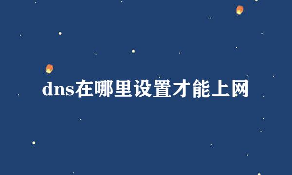 dns在哪里设置才能上网