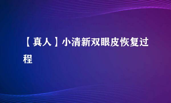 【真人】小清新双眼皮恢复过程